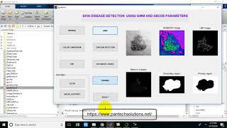 Skin Disease detection using Matlab