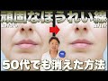 【４分ニベアマッサージ】頑固なほうれい線ならこれで消せ！！