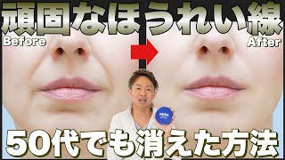 【４分ニベアマッサージ】頑固なほうれい線ならこれで消せ！！