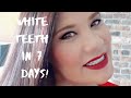 How To Get White Teeth In A Week!