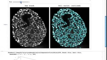 Mathematica in Cell Biology: Image Segmentation and Analysis of 3D Tumor Spheroids