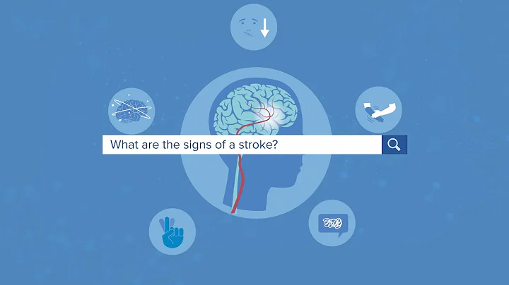 The Signs of a Stroke - Yale Medicine Explains - DayDayNews