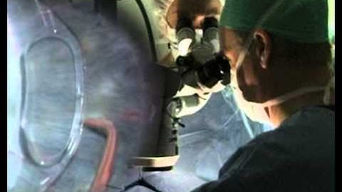 Enclavation of The Artisan PIOL by Dr Budo (Belgium)