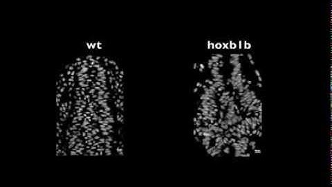 Anterior hindbrain morphogenesis in zebrafish