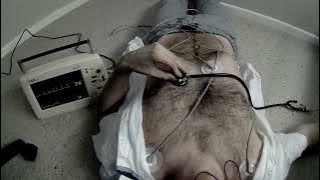 ECG and heartbeat sounds male