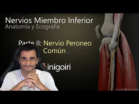 Vídeo: Neuropatía Del Nervio Peroneo