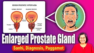 Enlarged Prostate Signs, Symptoms, Causes, Treatments (Mens Health) - Tagalog Health | Nurse Dianne