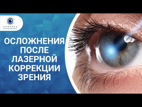 Осложнения после лазерной коррекции зрения - стоит ли бояться операции?