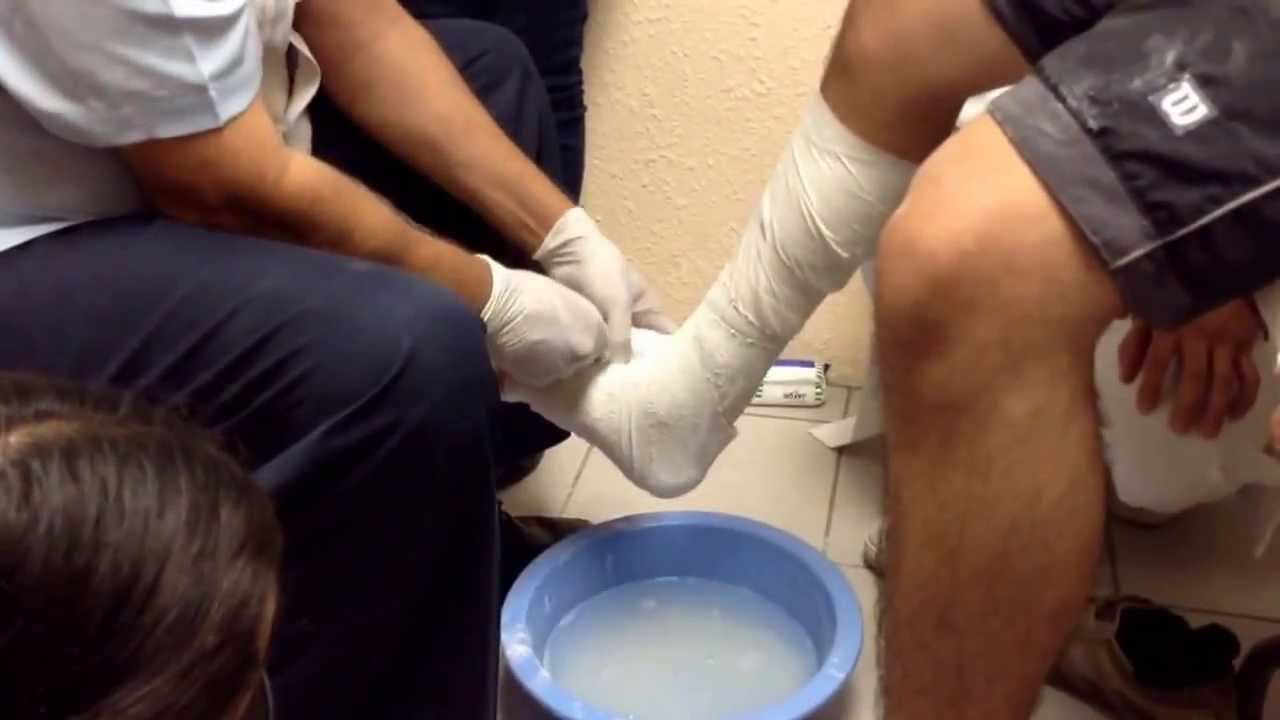 Yeso miembro inferior. Bota corta - YouTube