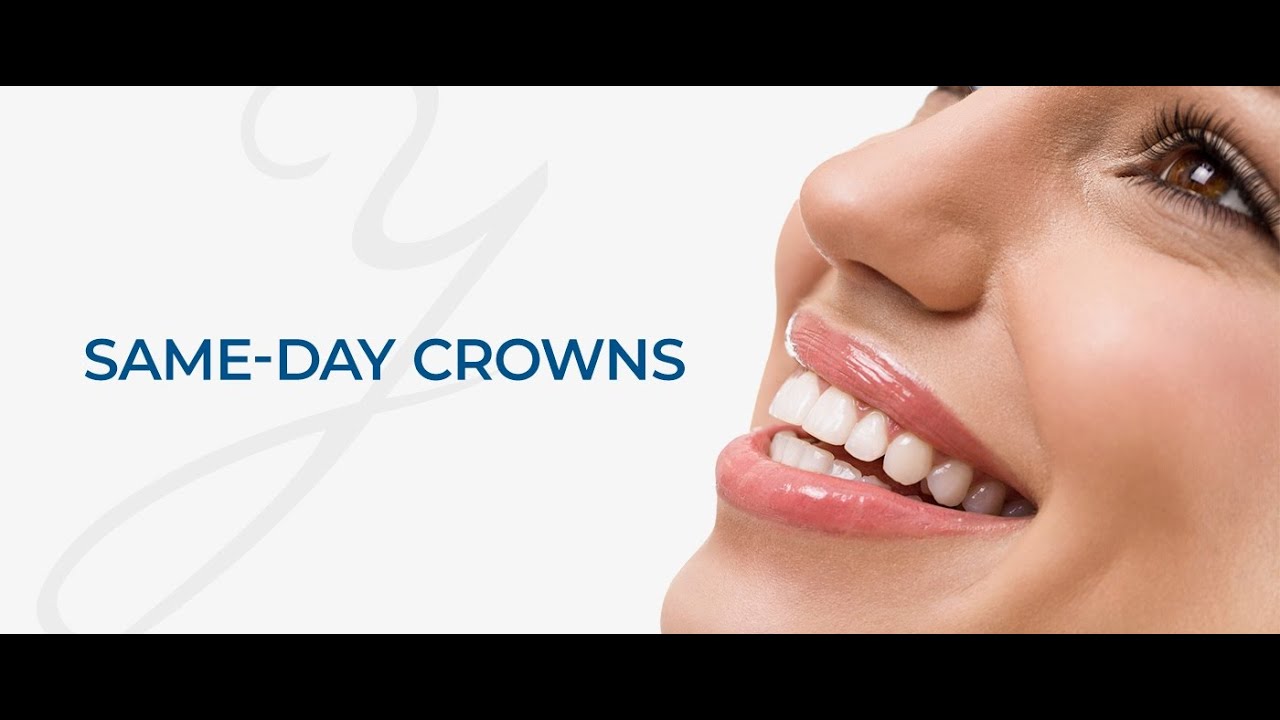 Restore Your Smile in Just One Visit: Same-Day Crowns Explained