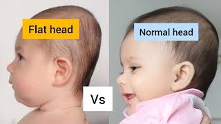 3 tricks to prevent flat heads in babies