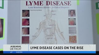 Michigan woman still feeling impacts of Lyme disease decades later