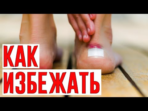 Бабушка Советовала Натирать Задник Обуви Восковой Свечой, но я Знаю ЛУЧШИЙ Способ Избежать Мозолей!