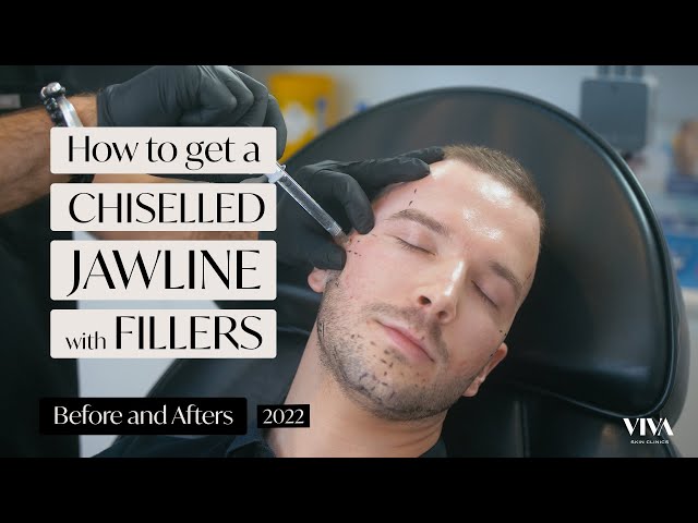 The Rise of Jawline Fillers for Men - The Cosmetic Skin Clinic