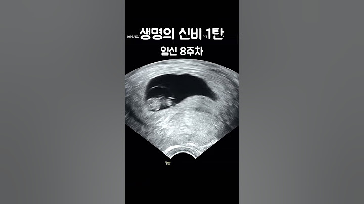 생명의 신비 1탄 [임신5-8주차] #shorts