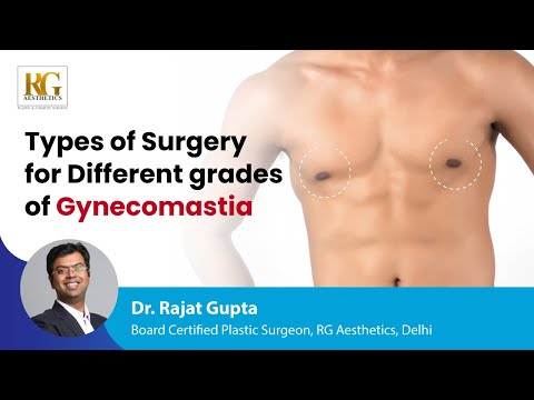 Gynecomastia के विभिन्न ग्रेड के लिए सर्जरी के प्रकार | डॉ रजत गुप्ता, प्लास्टिक सर्जन