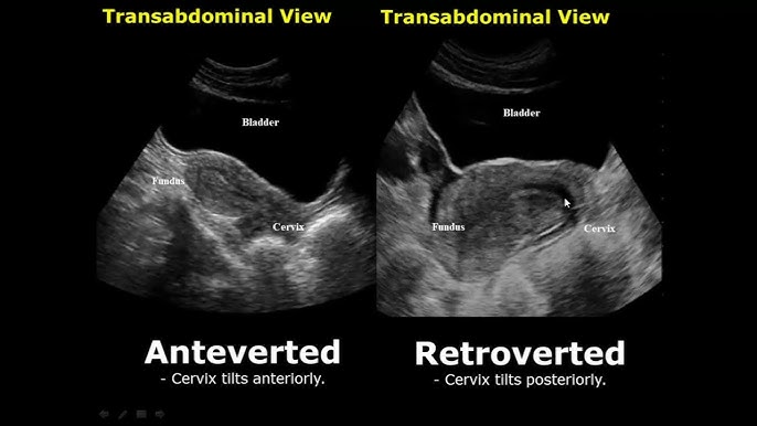 healthy-ovarian-ultrasound