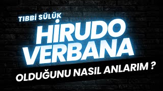 Hirudo Verbana Sülük Cinsi Nasıl Anlaşılır? Avcı Su Ürünleri Tıbbi Sülük