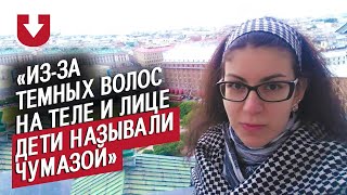 Девушки с гирсутизмом | Неудобные вопросы