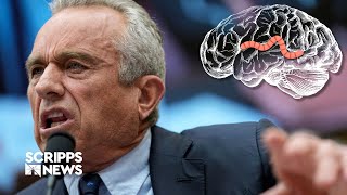Robert F. Kennedy Jr. apparently said a worm ate part of his brain