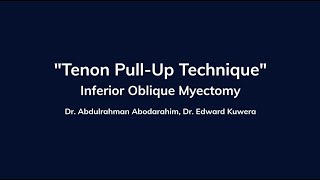 Inferior Oblique Myectomy Using The Tenon Pull-Up Technique