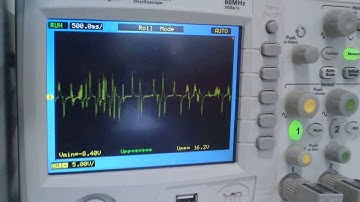 Detector pulso cardíaco