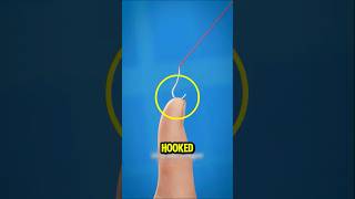 Dont Yank It Out The Safe Way To Remove A Fish Hook