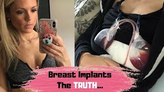 Breast Implants | Before & After Pics | Breast Implant Illness | Q&A