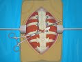 Operate now  scoliosis surgery  play scoliosis surgery games online