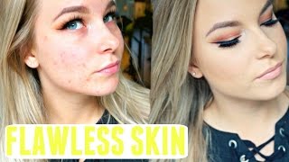 FLAWLESS Foundation Routine | Acne Prone Skin