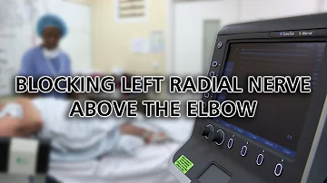 Blocking Left Radial Nerve above the elbow - Dr Zahid Sheikh