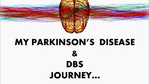 My PD and DBS Journey in 2021-2022.