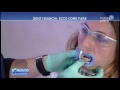 Il mio medico - Sbiancamento dei denti