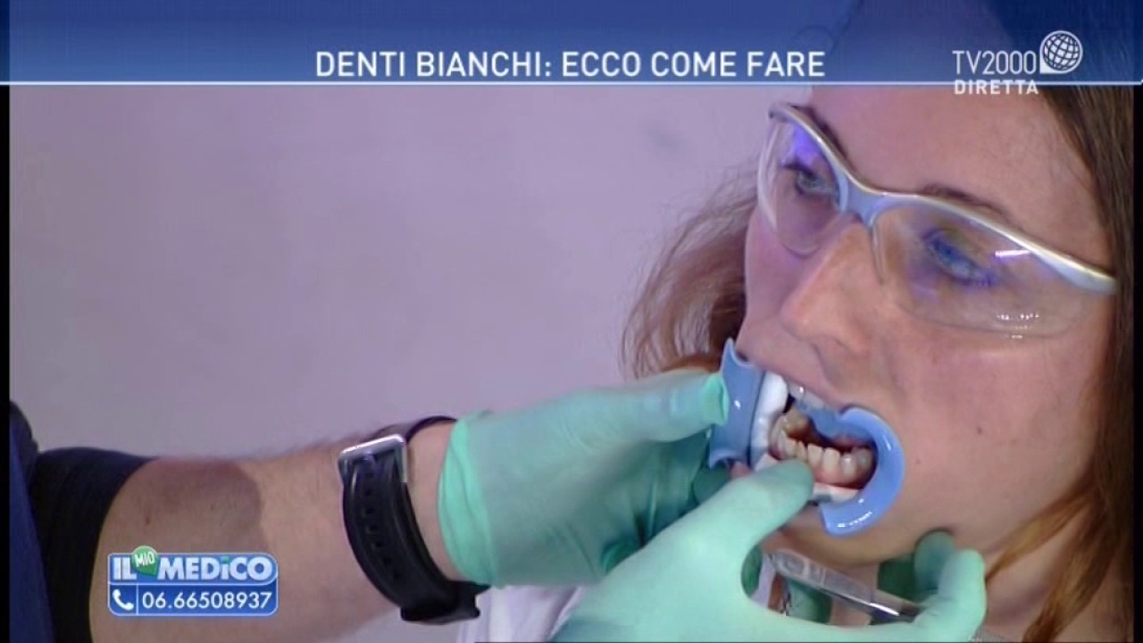 Il mio medico - Sbiancamento dei denti 