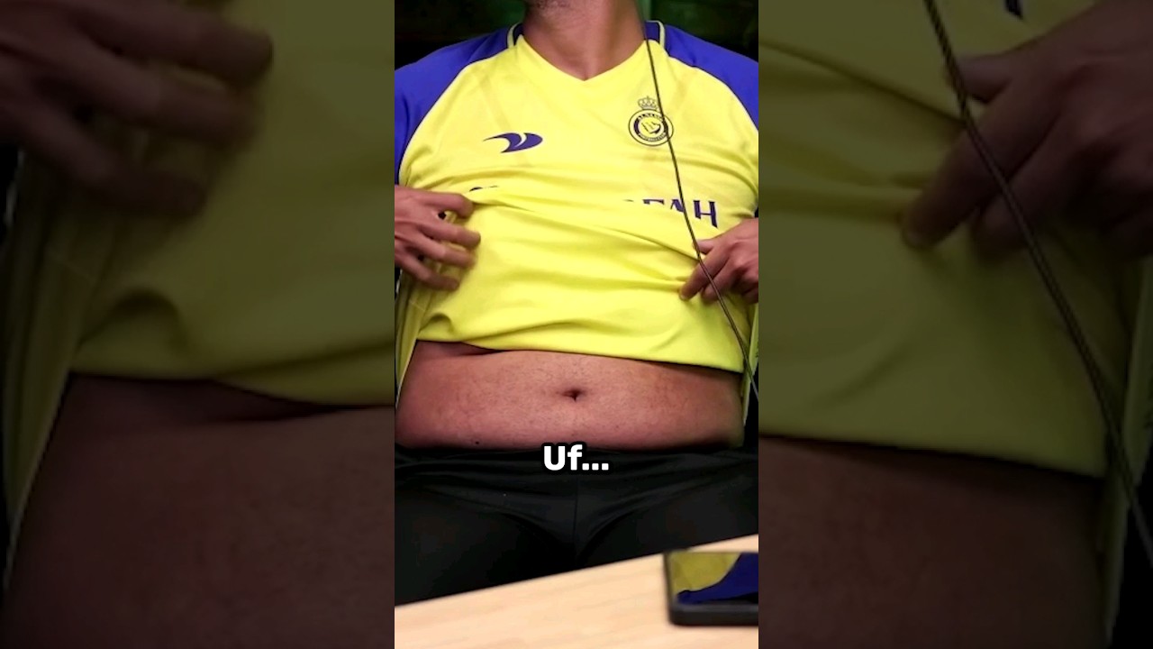 ASÍ QUEDÓ EL CAMBIO FÍSICO DE WILL... 🤣🥳#CambioFísico #Will