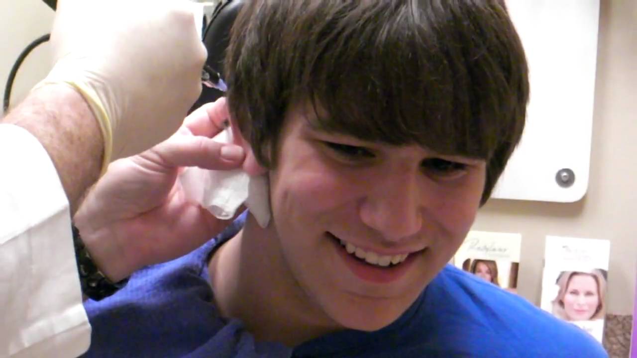 Fixing my cauliflower ear: numbing 