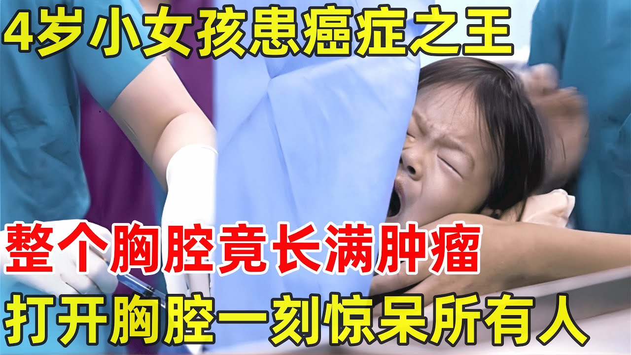 2024最新｜4岁小女孩患癌症之王!整个胸腔长满肿瘤,打开胸腔一刻在场医生震惊了【生命之路】