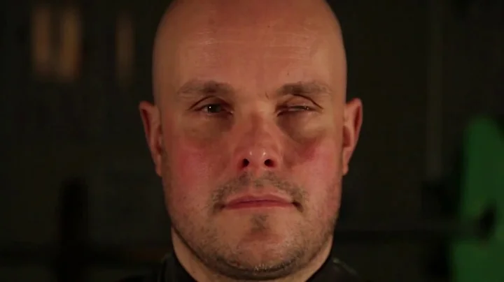 Mark Pollock