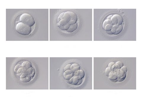 report embryo transfer Embryo transfer, the last step ultrasonic monitoring of embryo transfer was referred to in this report, however, the rank of this factor was not high. report embryo transfer Embryo transfer, the last step ultrasonic monitoring of embryo transfer was referred to in this report, however, the rank of this factor was not high.