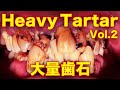 当院史上最強に硬い‼️大量歯石除去🦷vol.2 Removed a lot of hard tartar