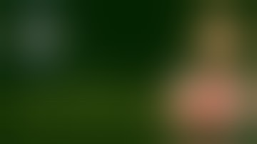 Radical Cystoprostatectomy with a Modification of Bricker Ureteroileal conduit