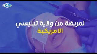 من امريكا إلى العراق ، إجراء عملية قص وشد الاجفان لمـريضتنا من ولاية تينيسي.