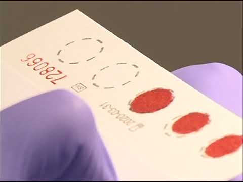 Newborn Screening Blood Spot Specimen Collection