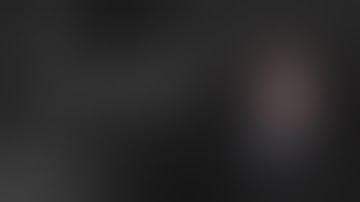 IntraOsseous BioPlasty® Procedure for a Patellar Bone Marrow Lesion