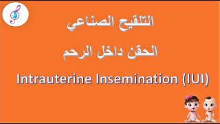 الحقن داخل الرحم - التلقيح الصناعي  IUI