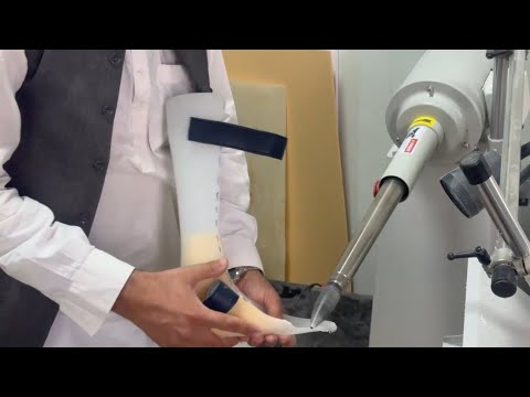 Little Boy Gets Ankle Foot Orthosis | HK AFO Cost