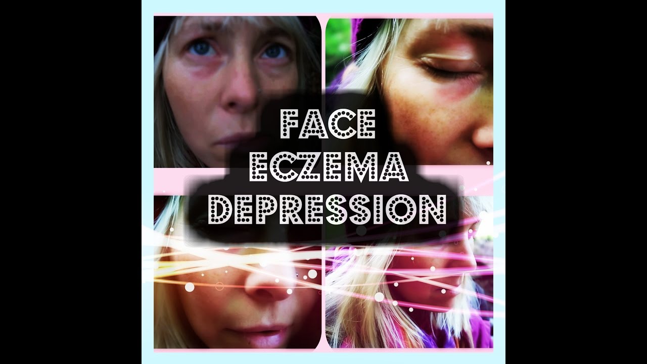 Face Eczema DEPRESSION