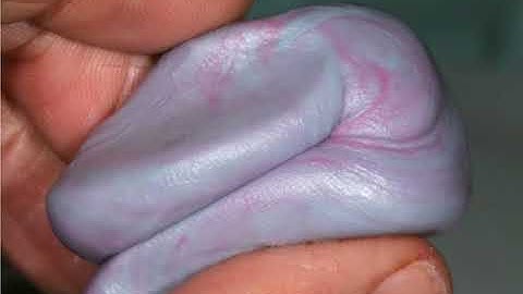 3C CLEAR CLONE CONCEPT DENTURE - By Drake Precision Dental Lab