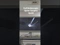 full Endoscopic Spine Surgery #psld #endoscopicspinesurgery