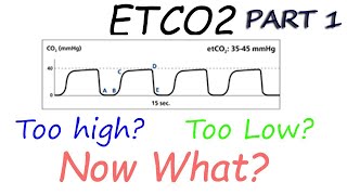 Capnography Waveform Interpretation (Etco2 basic's explained)